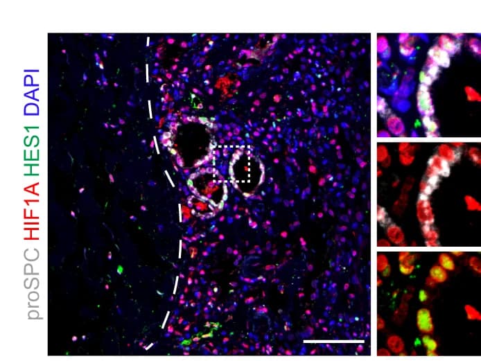 Open access visualization of Microscopy, Immunostaining, Paraquat-Injured Lung, proSPC, HIF1A