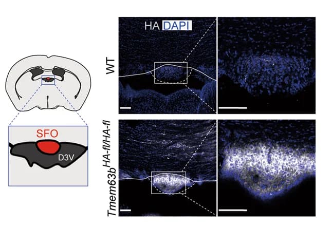 Open access visualization of Microscopy, Illustration, SFO Position, Brain, Immunochemical Detection
