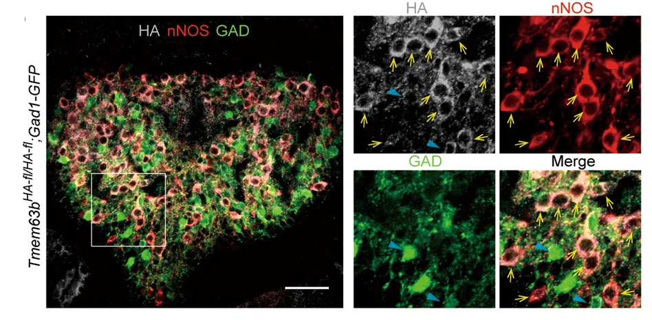 Open access visualization of Microscopy, Immunochemical Detection, HA, nNOS, GAD