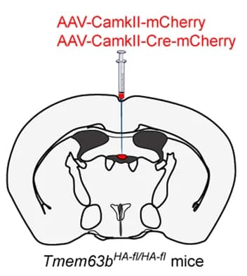Open access visualization of Illustration, Virus Injection, SFO, Tmem63b HA-fl/HA-fl Mice, TMEM63B Deletion