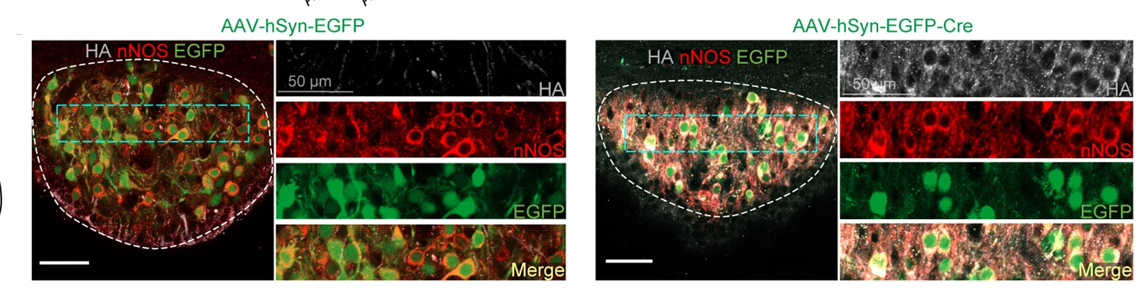 Open access visualization of Microscopy, Images, TMEM63B Re-expression, Immunostaining, HA