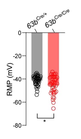 Open access visualization of Bar Plot, Scatter Plot, RMP, SFO TMEM63B Neurons, Mice