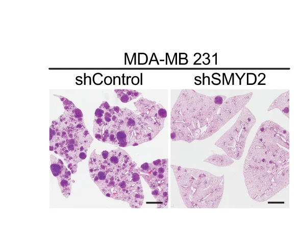 Open access visualization of Microscopy, Hematoxylin and Eosin Staining, Metastatic Foci, Lungs, NSG Mice