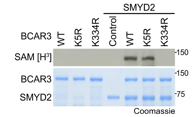 Open access visualization of Gel, Autoradiogram, Methylation Assay, Recombinant SMYD2, Recombinant BCAR3
