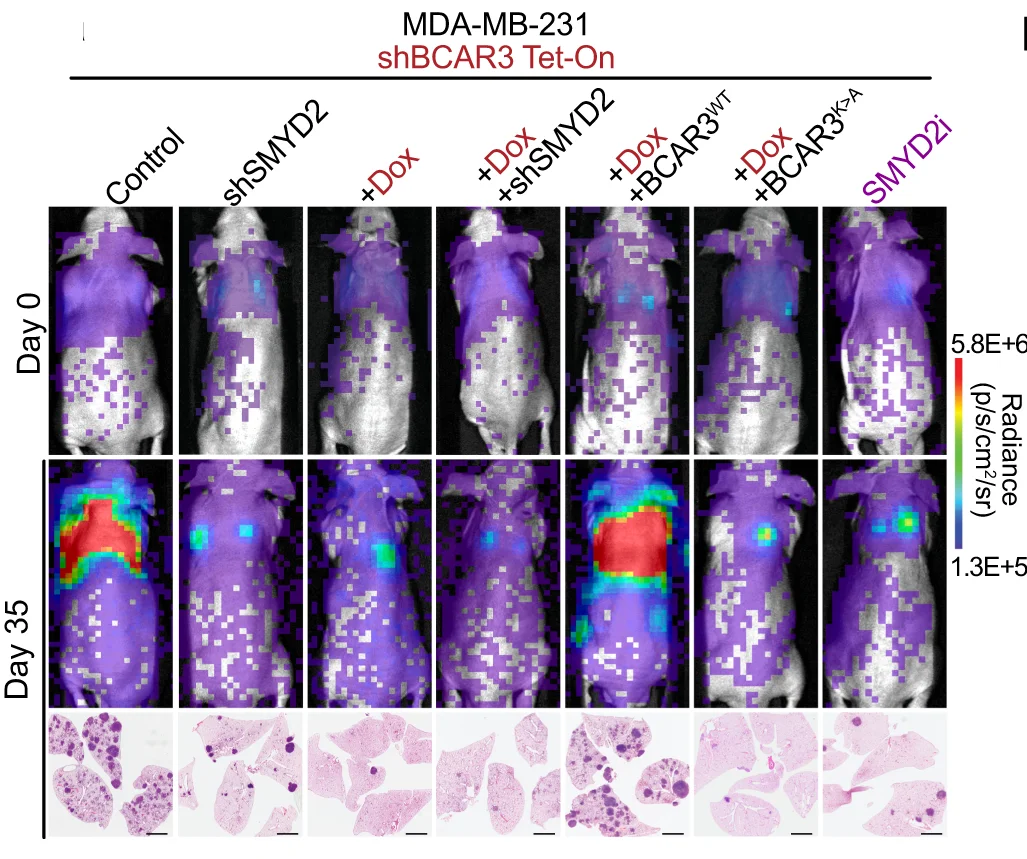 Open access visualization of Photo, Microscopy, Bioluminescence Imaging, Intravenous Transplantation, MDA-MB-231 Cells