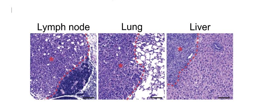 Open access visualization of Microscopy, HE Staining, Metastases, Tissues, MDA-MB-231 Cells