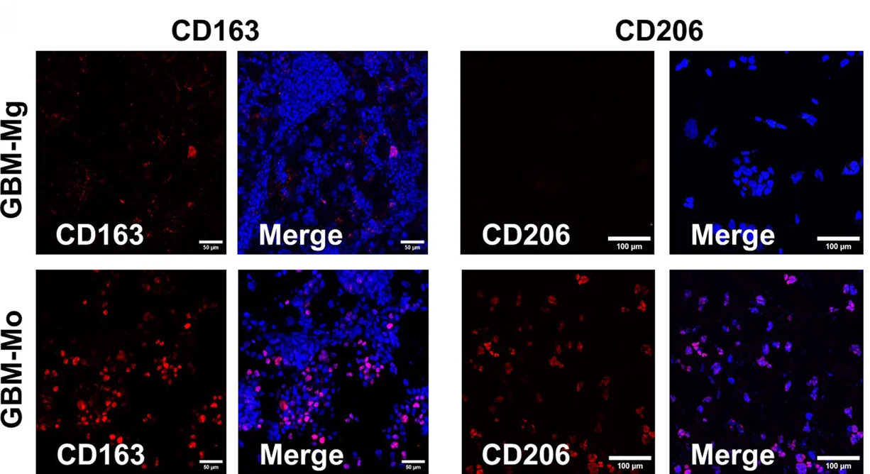 Open access visualization of Microscopy, Immunofluorescence Staining, Immunosuppressive Markers, CD163, CD206