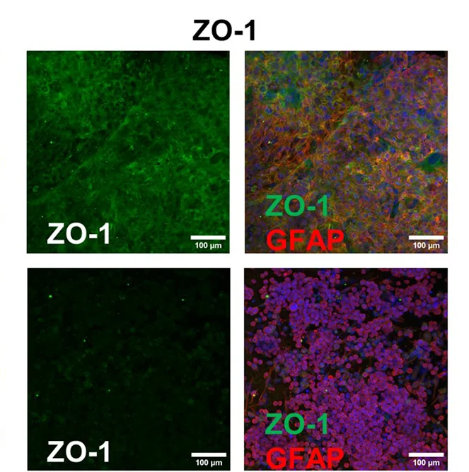 Open access visualization of Microscopy, Immunofluorescence Staining, Tight Junction Marker, ZO-1, Glial Cell Marker