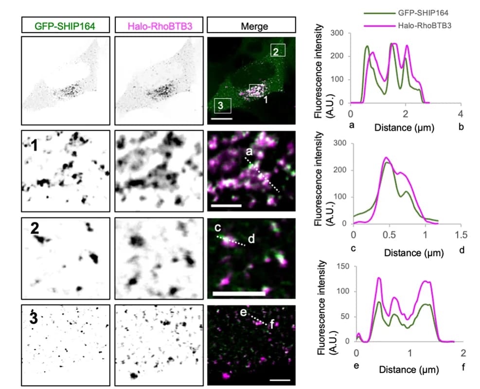 Open access visualization of Line Plot, Microscopy, Photo, HEK293 Cell, GFP-SHIP164