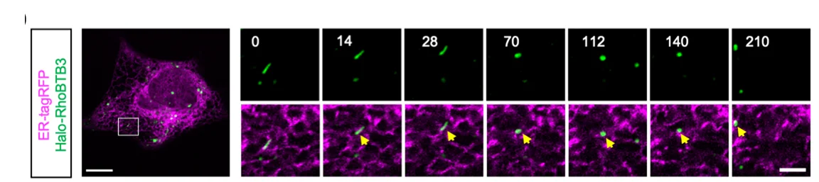 Open access visualization of Microscopy, Co-IP Assay, Endogenous SHIP164, Endogenous Vps26B, GFP-RhoBTB3