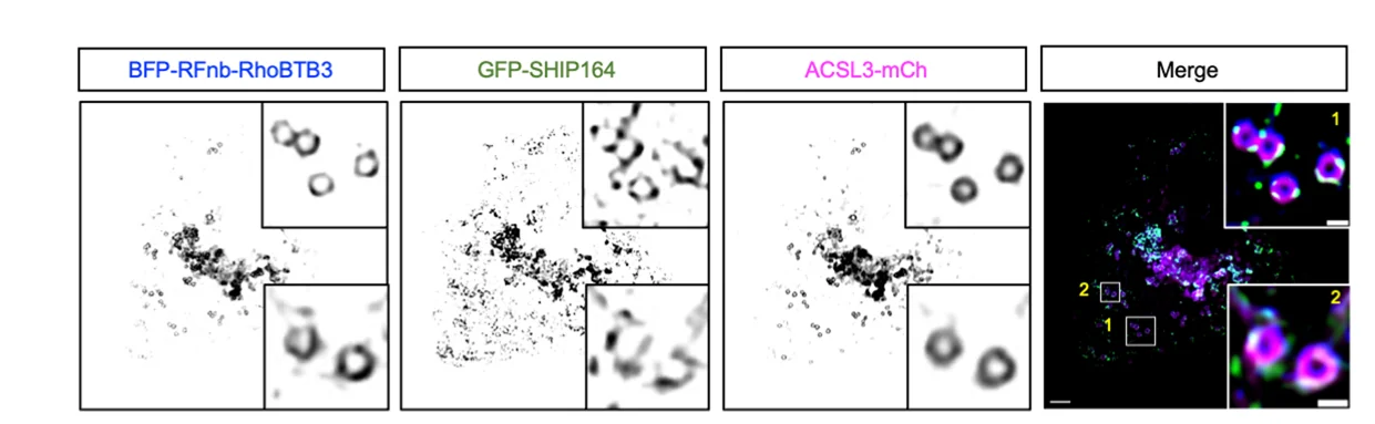 Open access visualization of Microscopy, HEK293 Cell, BFP-RFPnb-RhoBTB3, GFP-SHIP164, ACSL3-mCh