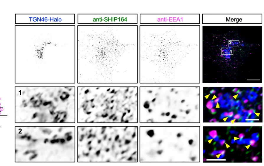 Open access visualization of Microscopy, Fixed HEK293 Cell, TGN46-Halo, SHIP164 Antibody, EEA1 Antibody