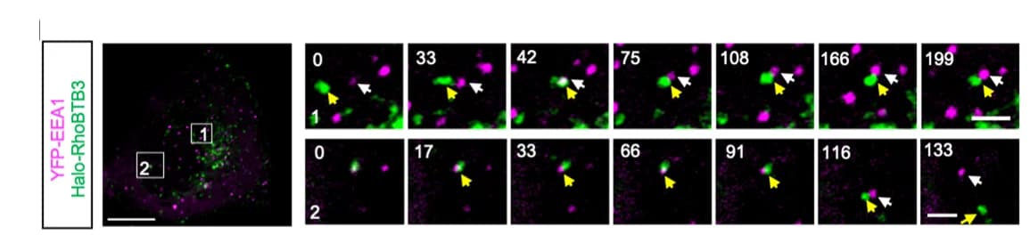 Open access visualization of Microscopy, HEK293 Cell, YFP-EEA1, Halo-RhoBTB3, Time-Lapse Imaging