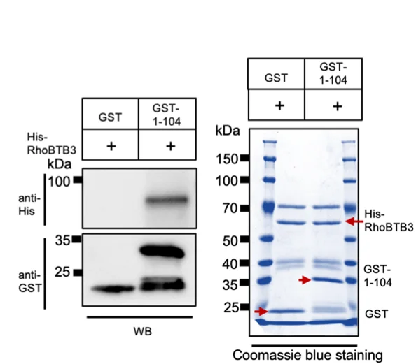 Open access visualization of Gel, GST-Pull-Down Assay, Chorein N Domain, SHIP164, His-RhoBTB3