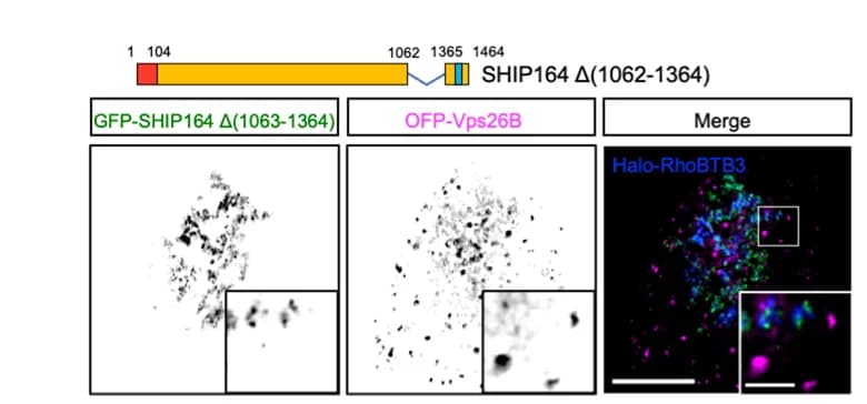 Open access visualization of Microscopy, HEK293 Cells, SHIP164-, OFP-Vps26B, Cell Images