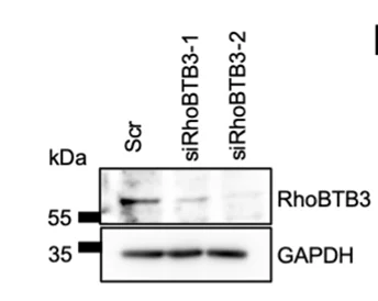 Open access visualization of Gel, Immunoblot, RhoBTB3, siRNA