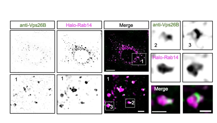 Open access visualization of Microscopy, HEK293 Cells, Vps26B Antibody, Halo-Rab14, Immunofluorescence
