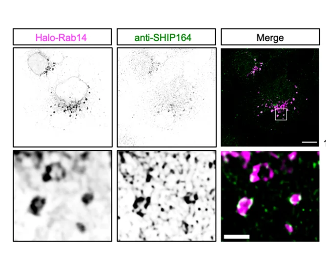 Open access visualization of Microscopy, HEK293 Cells, SHIP164 Antibody, Halo-Rab14, Fixed Cells