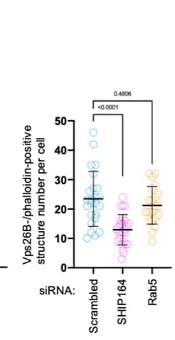 Open access visualization of Scatter Plot, Error Bars, Endosome Buds, Vps26B, Actin
