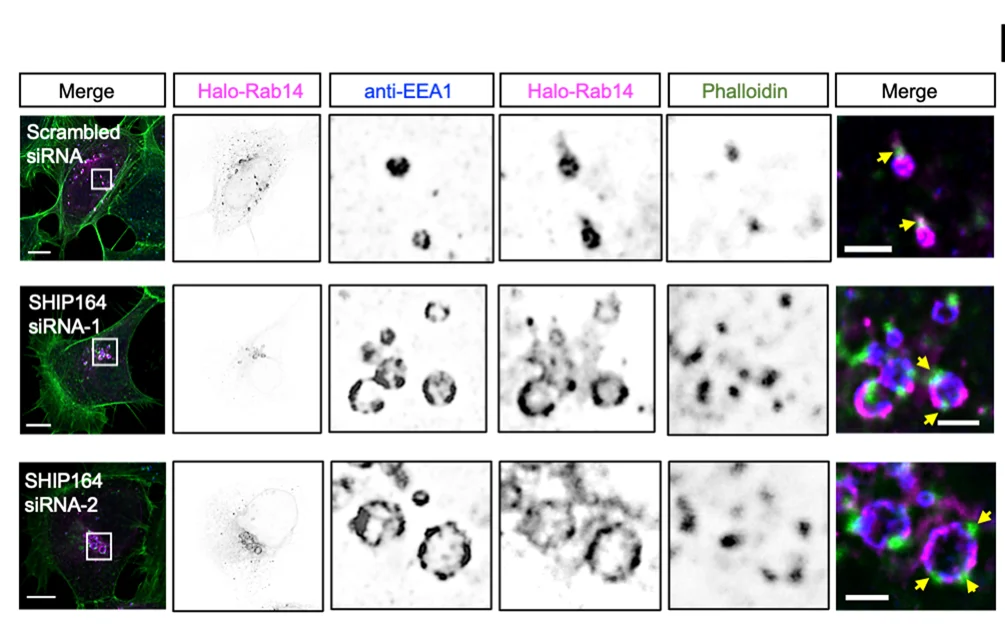 Open access visualization of Microscopy, Photo, HEK293 Cells, Halo-Rab14, EEA1 Antibody