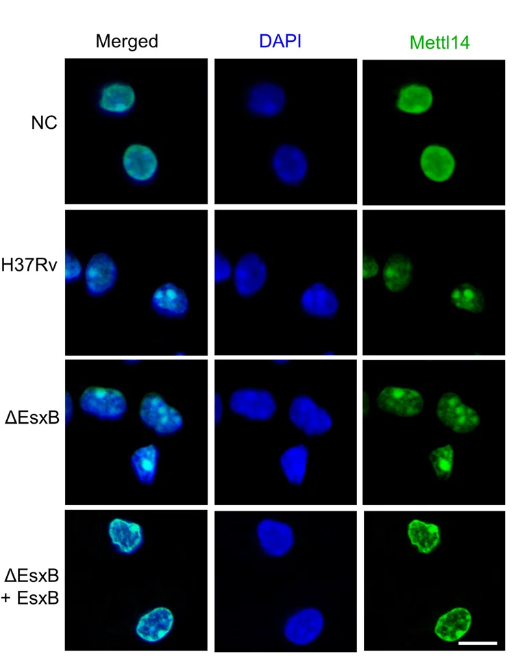 Open access visualization of Microscopy, Immunofluorescence Staining, Mettl14, Mouse Peritoneal Macrophages, H37Rv