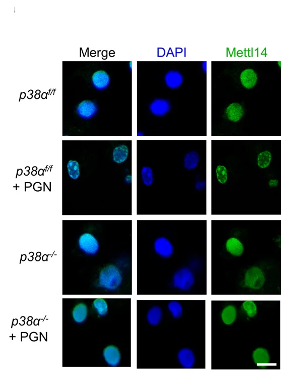 Open access visualization of Microscopy, Immunofluorescence Staining, Peritoneal Macrophages, Mettl14, Mice