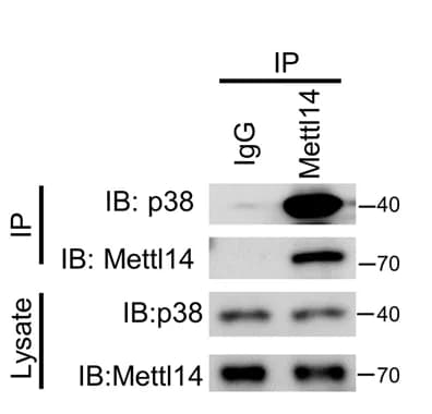 Open access visualization of Gel, Endogenous Interaction, Mettl14, p38
