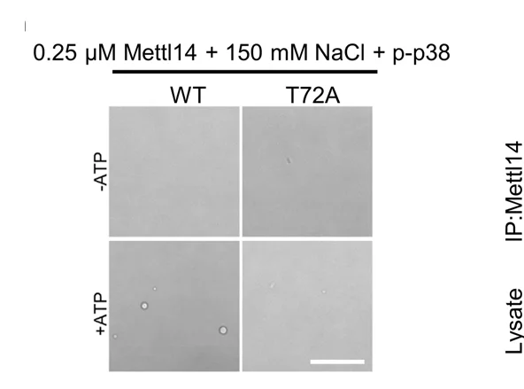 Open access visualization of Microscopy, Mettl14-WT, Mettl14-T72A, In Vitro Kinase Assay, In Vitro LLPS Assay