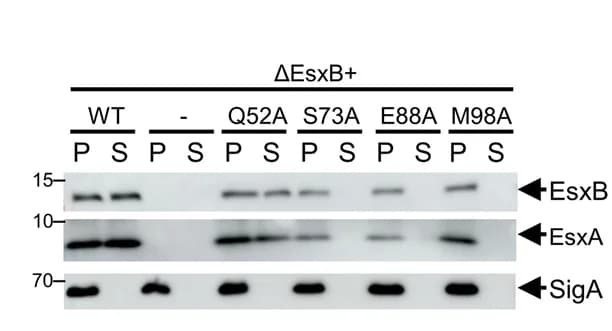 Open access visualization of Gel, IB, EsxA, EsxB, H37Rv