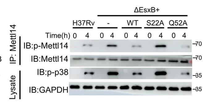 Open access visualization of Gel, IB, Mouse Peritoneal Macrophages, H37Rv, EsxB