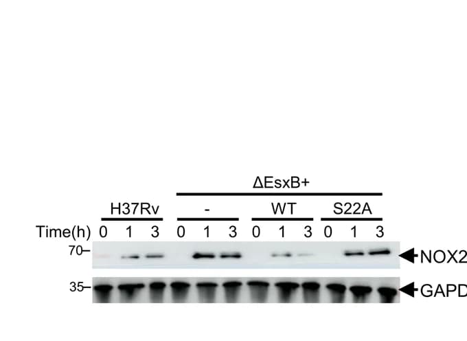 Open access visualization of Gel, IB, Mouse Peritoneal Macrophages, H37Rv, EsxB