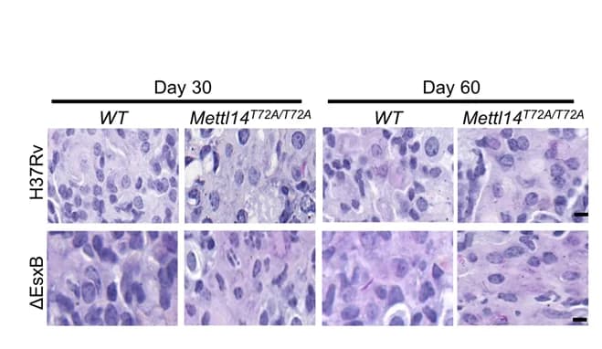 Open access visualization of Microscopy, Lung Sections, AcidFast Staining, Histology, Scale Bar