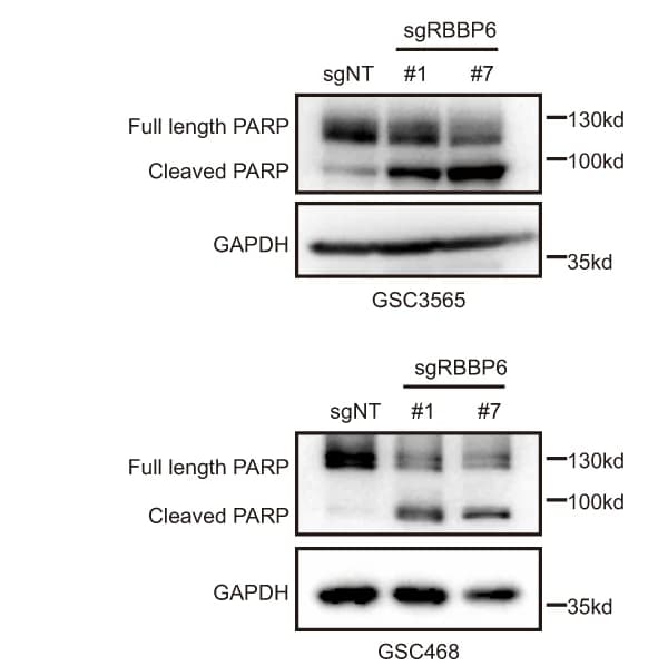 Open access visualization of Gel, Western Blot, PARP, GSC468 Cells, GSC3565 Cells