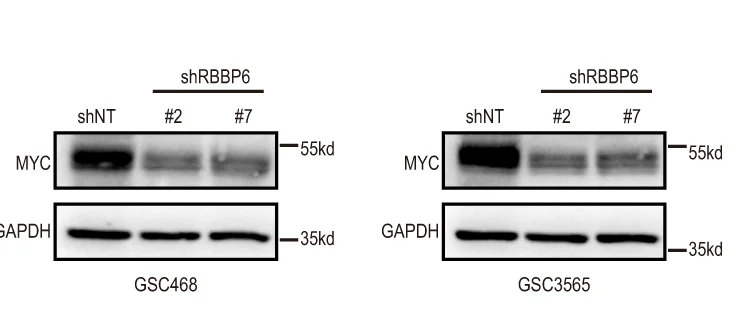 Open access visualization of Gel, Protein Levels, MYC, GSC468 Cells, GSC3565 Cells