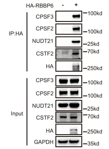 Open access visualization of Gel, HEK293T Cells, HA-RBBP6 Plasmids, Transfection, IP/IB