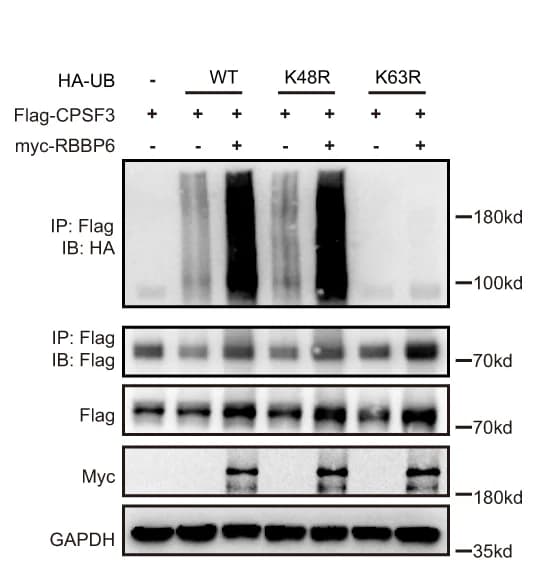 Open access visualization of Gel, HEK293T Cells, Flag-CPSF3, Myc-RBBP6, HA-UB Mutant Plasmids