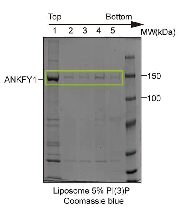 Open access visualization of Gel, Liposome, Flotation Assay, SDS-PAGE, Coomassie Blue Staining