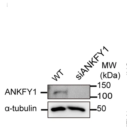Open access visualization of Gel, Knockdown Efficiency, U 2 OS Cells, Cell Lysates, Immunoblotting