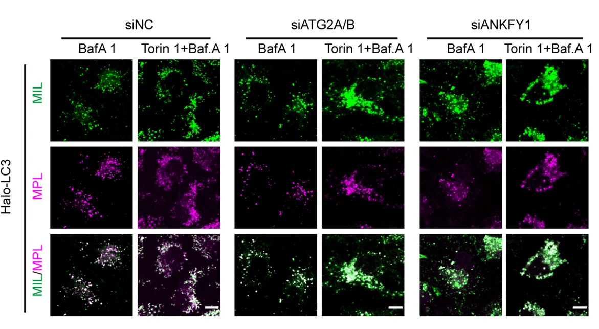 Open access visualization of Microscopy, HaloTag-LC3, HT-LC3, U 2 OS Cells, siNC