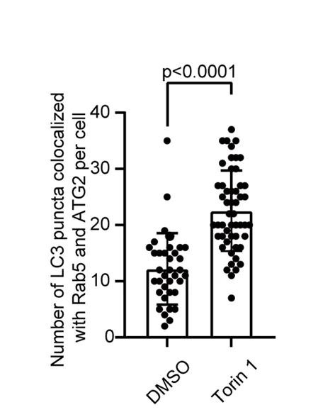 Open access visualization of Scatter Plot, Box Plot, LC3 Puncta, Rab5-mCherry Puncta, ATG2A-GFP Puncta