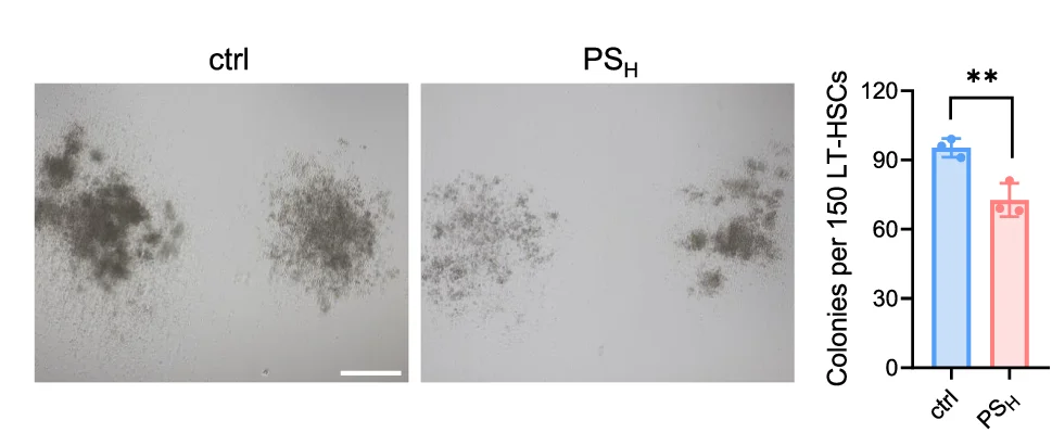 Open access visualization of Bar Plot, Error Bars, Microscopy, Photo, CFUs