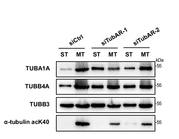 Open access visualization of Gel, TUBA1A, TUBB4A, TUBB3, Soluble Tubulin Fraction