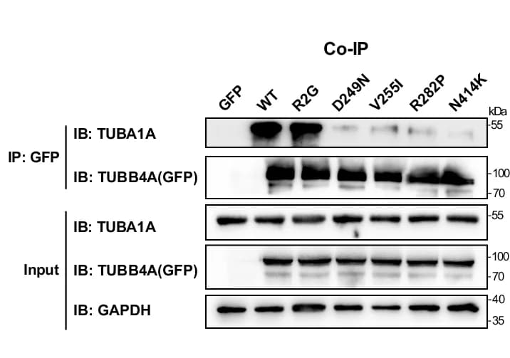 Open access visualization of Gel, Co-IP, TUBA1A, GFP-tagged TUBB4A, Neuro-2a Cells