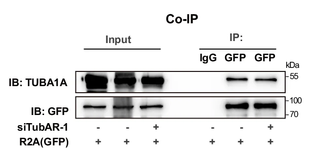 Open access visualization of Gel, Co-IP, TUBA1A, GFP-TUBB4A-R2G, GFP-TUBB4A-R2A