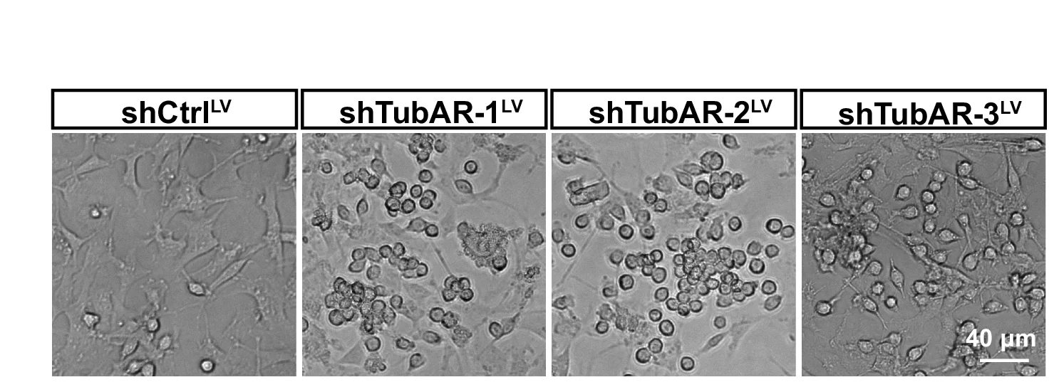 Open access visualization of Microscopy, Oli-neu Cells, shCtrl LV, sh TubAR s LV, Lentivirus