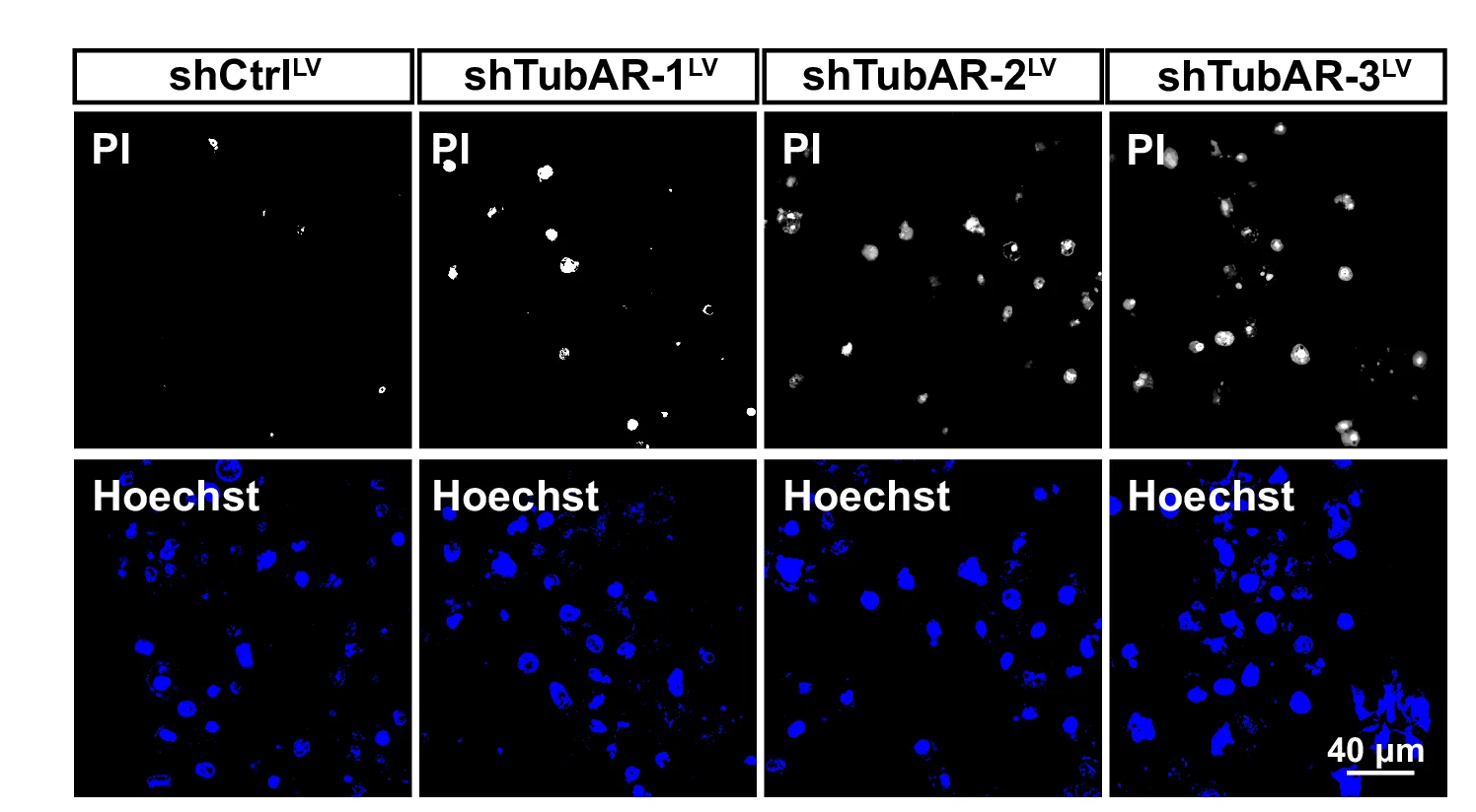 Open access visualization of Microscopy, PI Staining, Oli-neu Cells, shCtrl LV, sh TubAR s LV