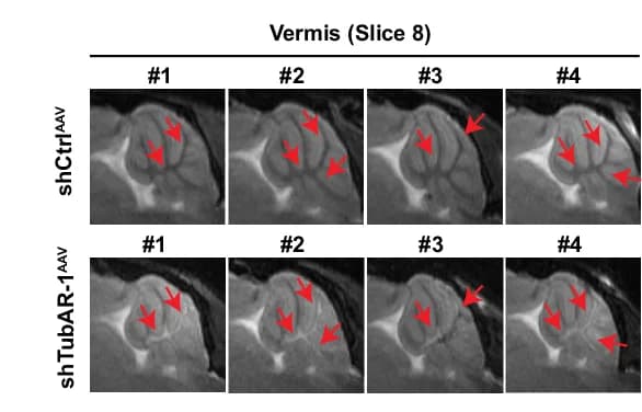 Open access visualization of Microscopy, MRI, AAV, Vermis