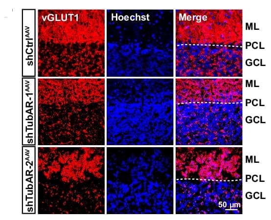 Open access visualization of Microscopy, Immunostaining, vGLUT1, AAV, Cerebellar Cortex