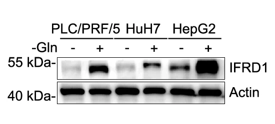 Open access visualization of Gel, Western Blot, IFRD1 Expression, PLC/PRF/5 Cells, HuH7 Cells