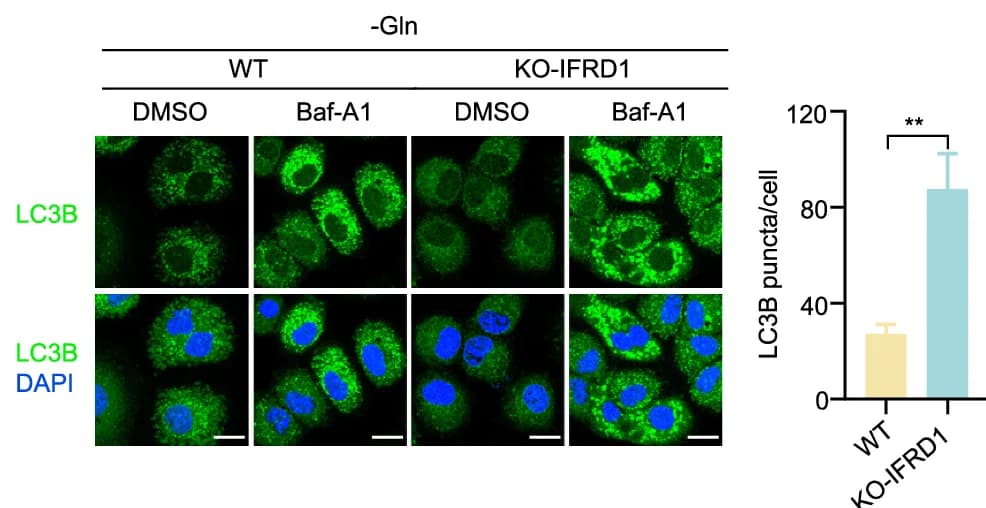 Open access visualization of Bar Plot, Microscopy, Photo, Error Bars, LC3B Immunostaining